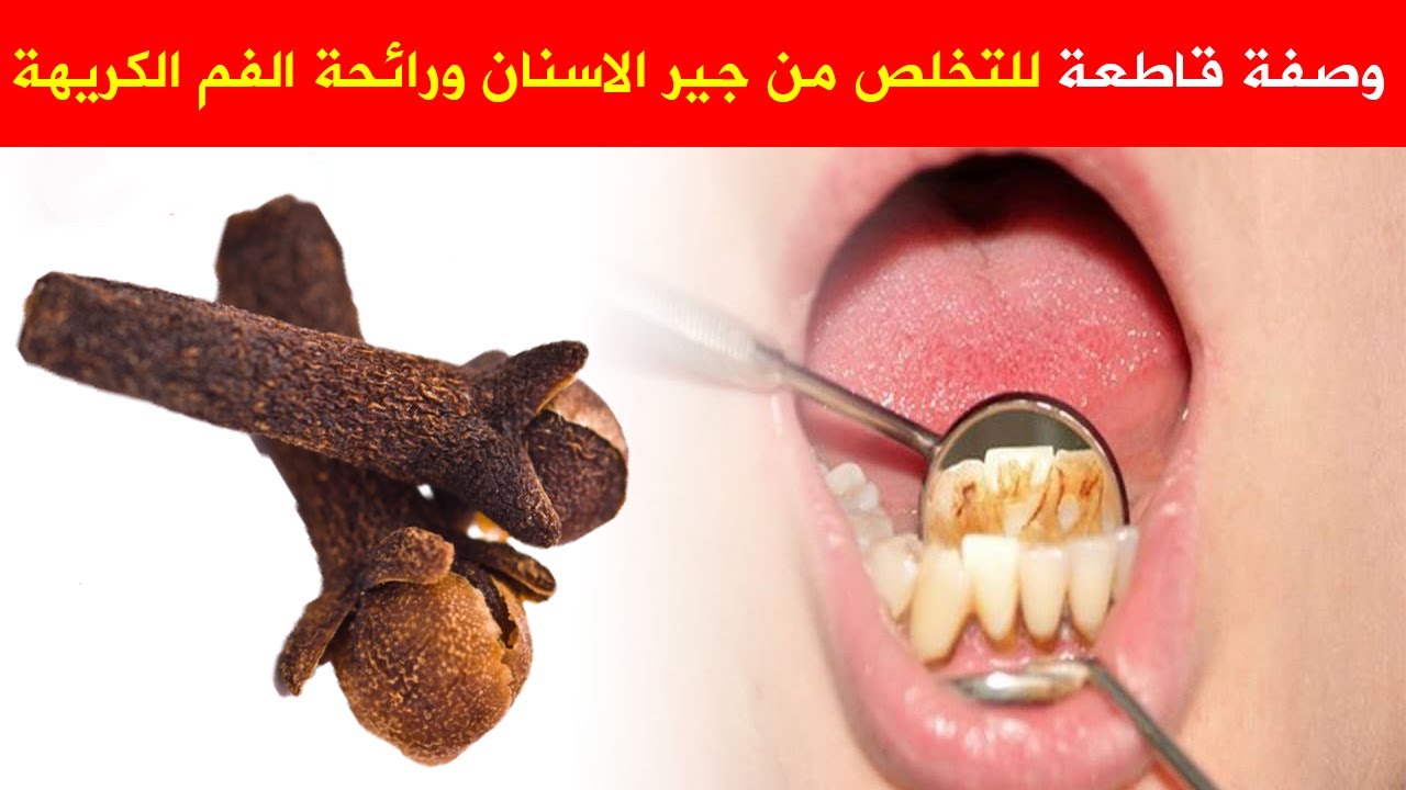 كيفية التخلص من رائحة الفم الكريهة نهائياً في رمضان وغير رمضان