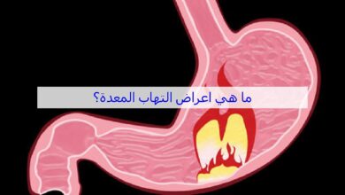 ماهي أعراض التهاب المعدة