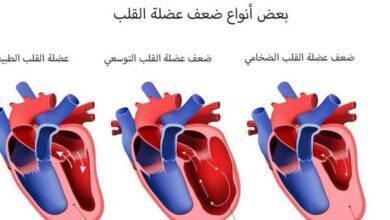 أخطر أنواع أمراض القلب وأسبابها وكيفية تشخيصها
