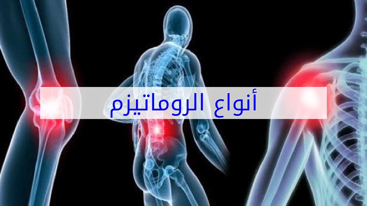 انواع الروماتيزم وأسبابه وعلاجه